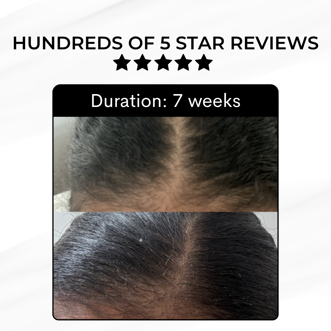 Hair Growth Kit
