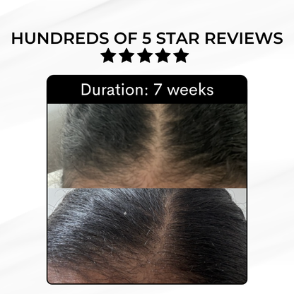 Hair Growth Kit