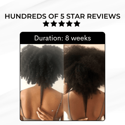 Growth and Renewal Oil 50ml - Luscious Locks co