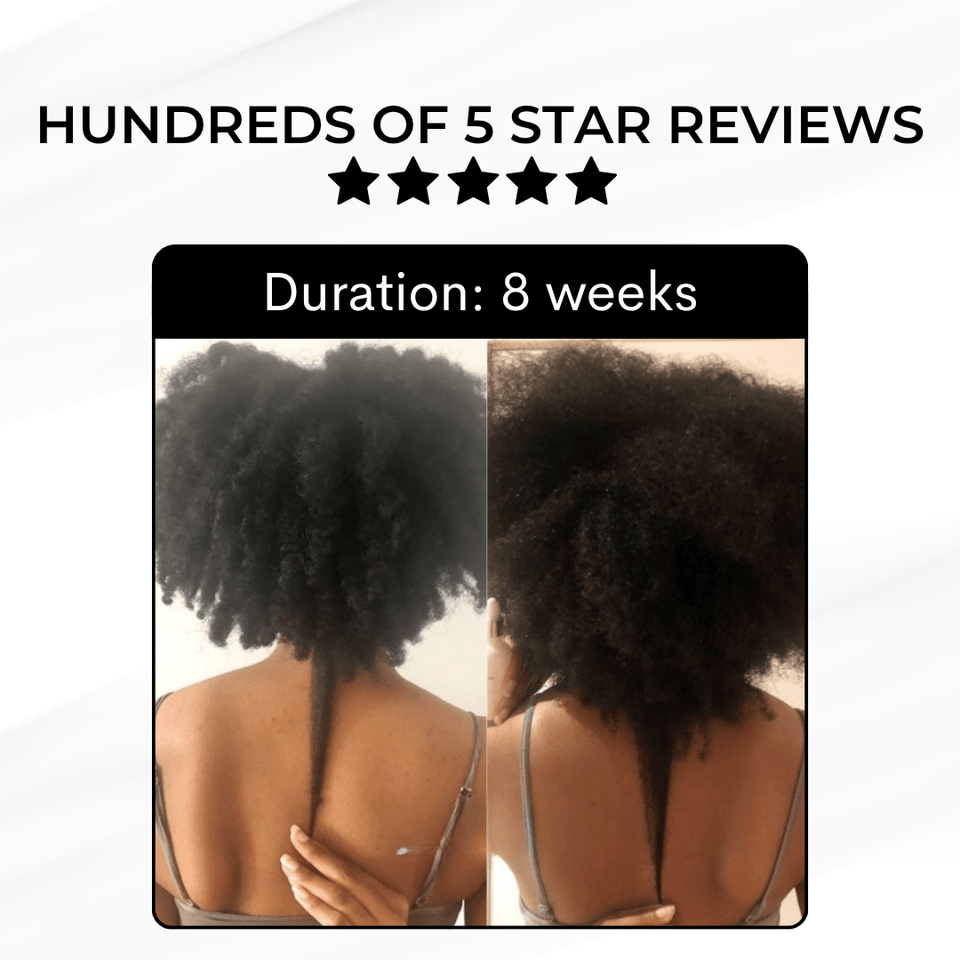 Growth and Renewal Oil 50ml - Luscious Locks co