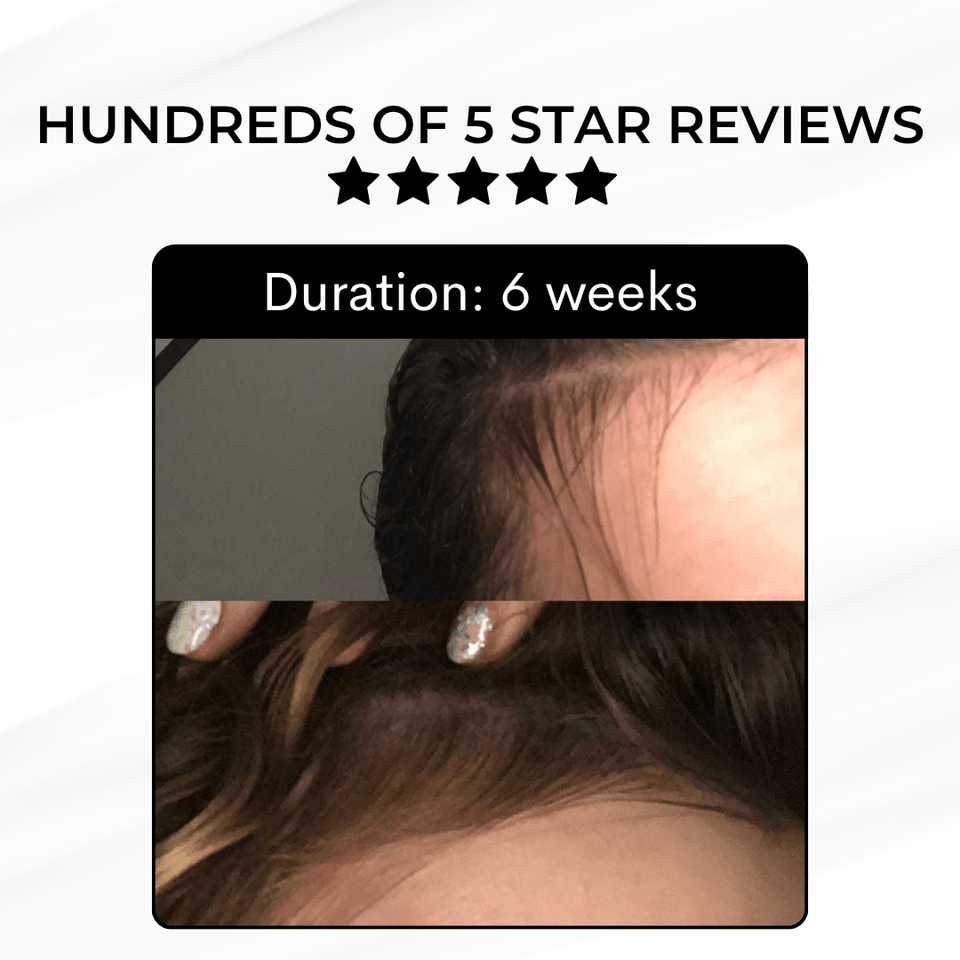 Growth and Renewal Oil 50ml - Luscious Locks co