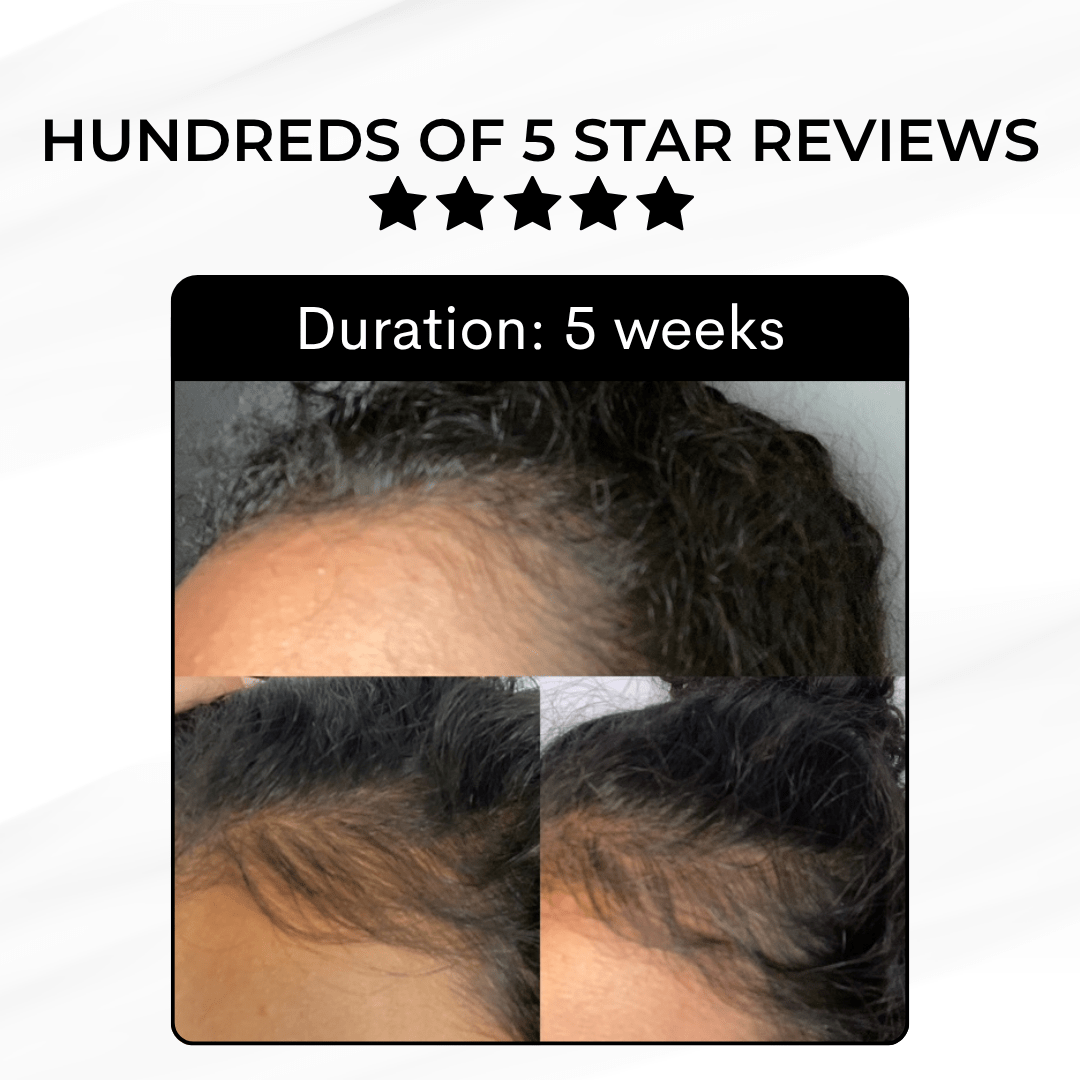 Hair Growth Kit - Luscious Locks co