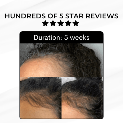 Hair Growth Kit - Luscious Locks co