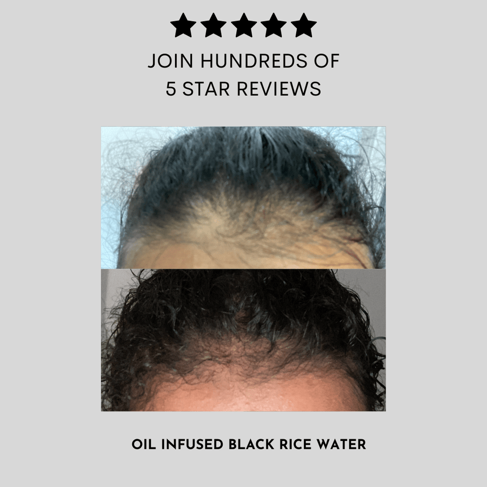 Oil - Infused Black Rice Water 100ml - Luscious Locks co
